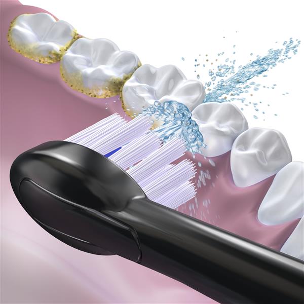 Waterpik™ Sonic-Fusion™ Full-Size Replacement Flossing Brush Heads – Black – Black (SFFB-2EB) - Image 5
